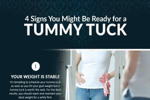 4 Signs You Might Be Ready for a Tummy Tuck [Infographic]