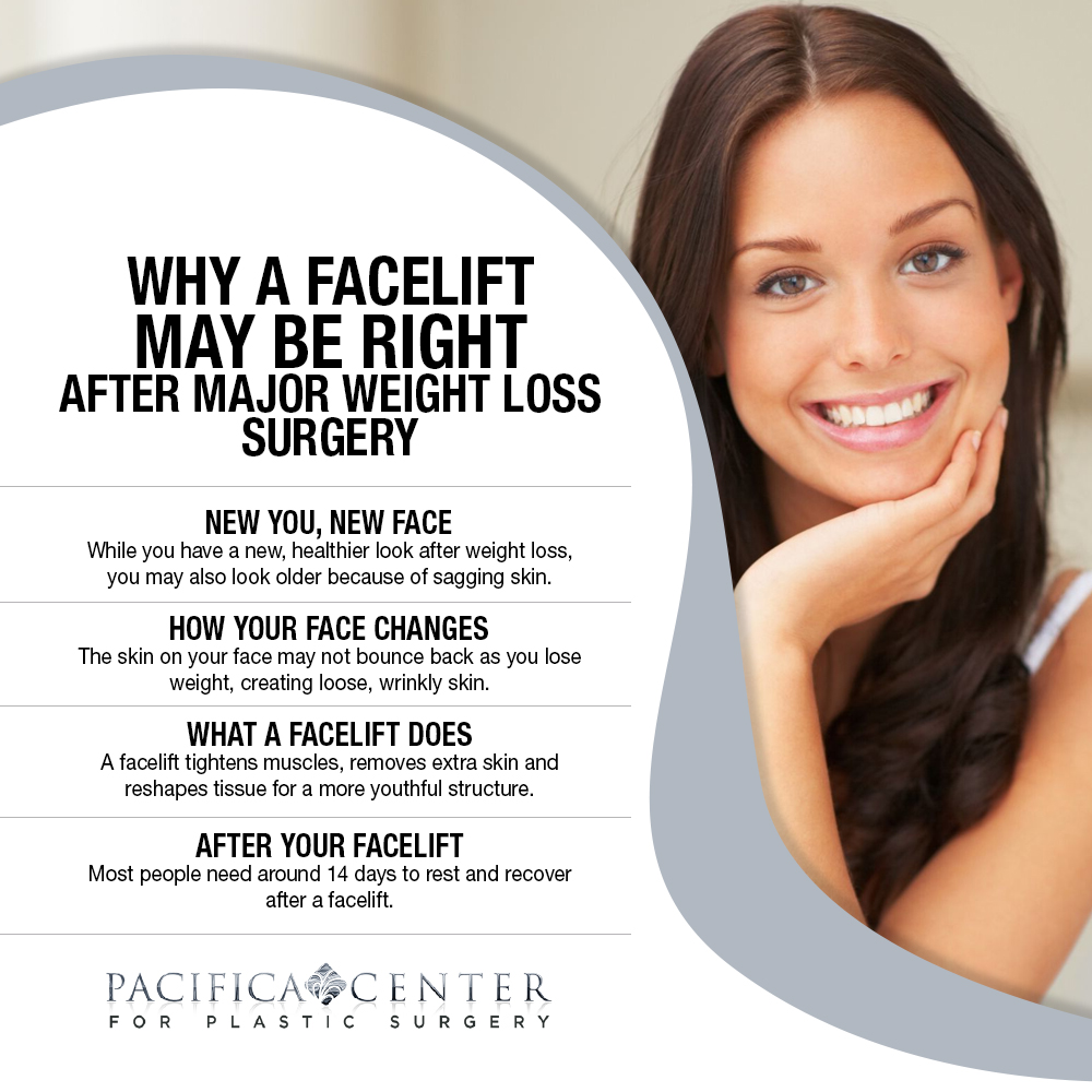 Why A Facelift May Be Right After Major Weight Loss Surgery [Infographic]